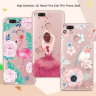 ТПУ накладка Brilliant для Xiaomi Mi A1 фото 2 — eCase