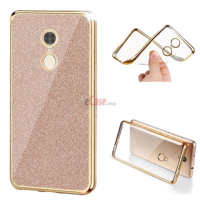 ТПУ накладка Electroplating Sparkle для Xiaomi Mi5X — eCase